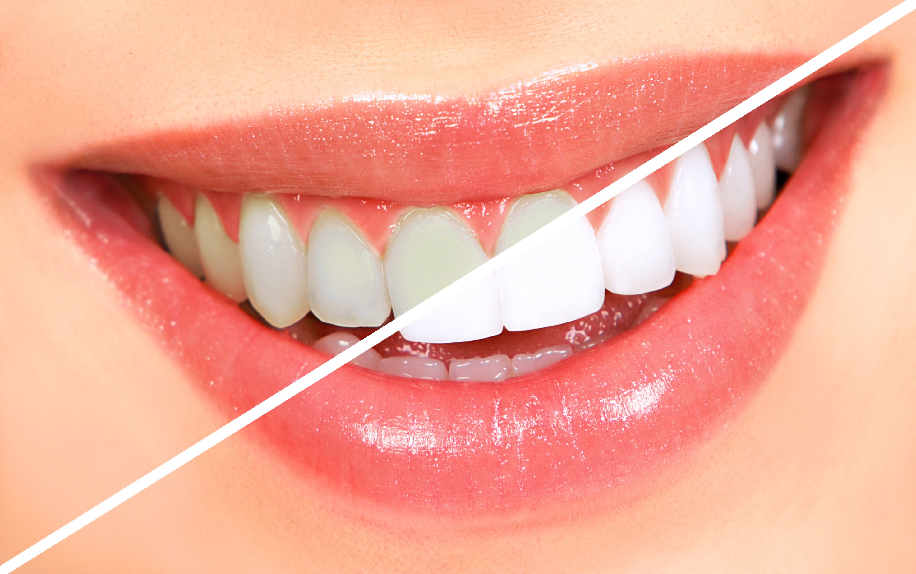 Dental Implants in Nadiad